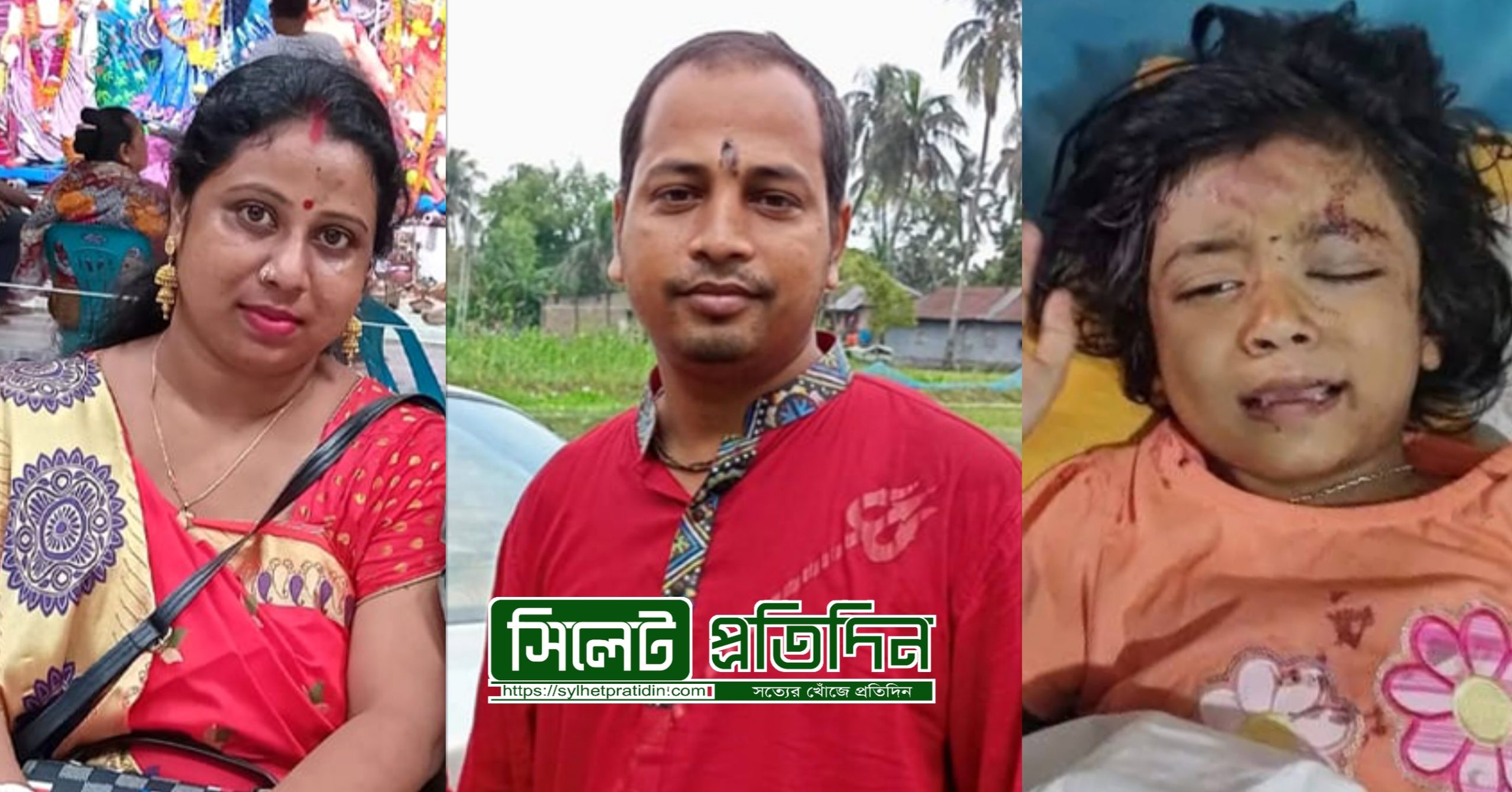 সড়ক দুর্ঘটনায় নিঃস্ব পরিবার,অনিশ্চিত ছোট্ট আরাধ্যার ভবিষ্যৎ