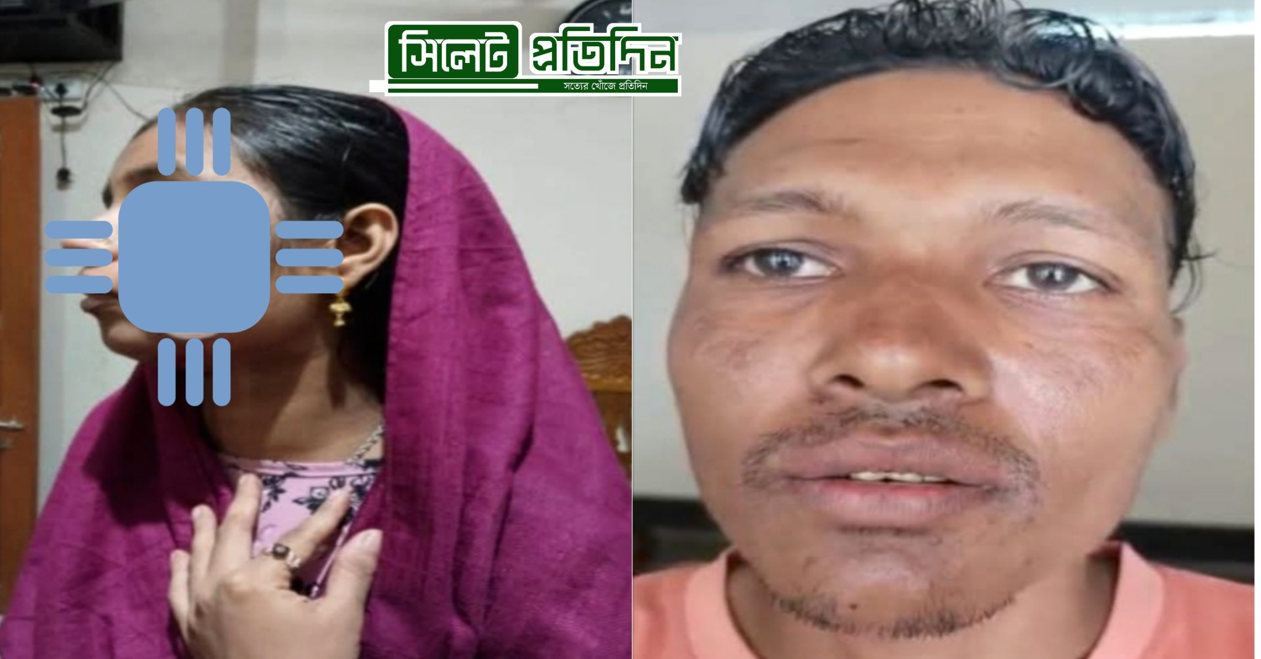 কুলাউড়ায় গৃহবধূর গালে কামড়;টিটু গ্রেপ্তার